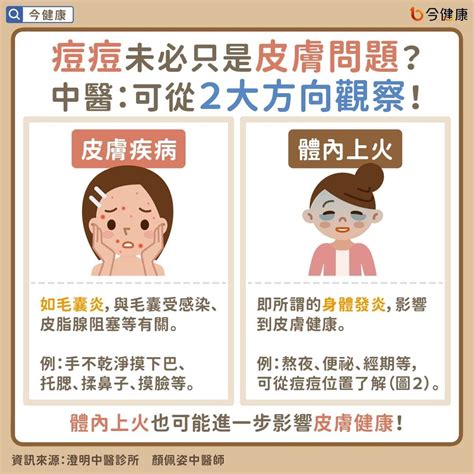 喉嚨長一顆痘痘|脖子、下巴邊緣狂冒痘是因為....解析身體各部位長痘原因